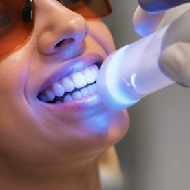 Teeth Whitening